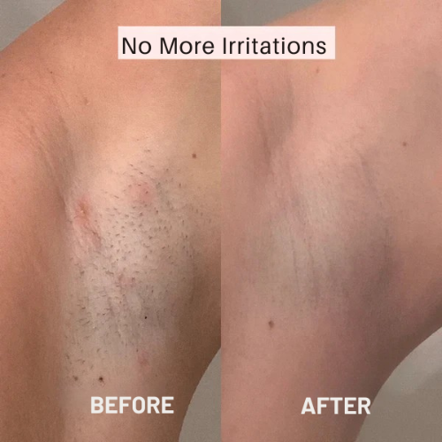 Rasoio elettrico donna – Pelle liscia senza irritazione 